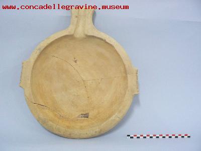 immagine reperto 1600000076 PELVIS